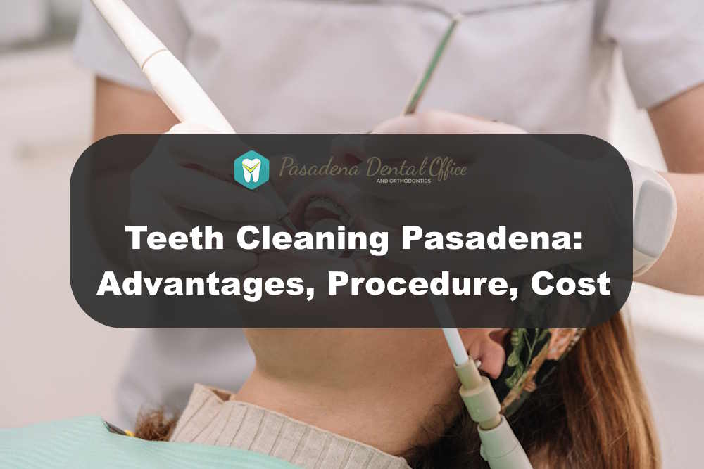 Teeth Cleaning Pasadena
